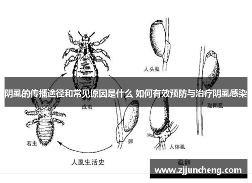 阴虱的传播途径和常见原因是什么 如何有效预防与治疗阴虱感染